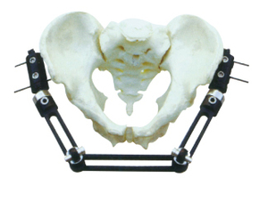 骨科外固定支架骨盆骨折(A型)优惠价1300元,外