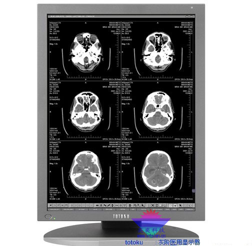 3M单色医用液晶显示器21寸东特Totoku ME35