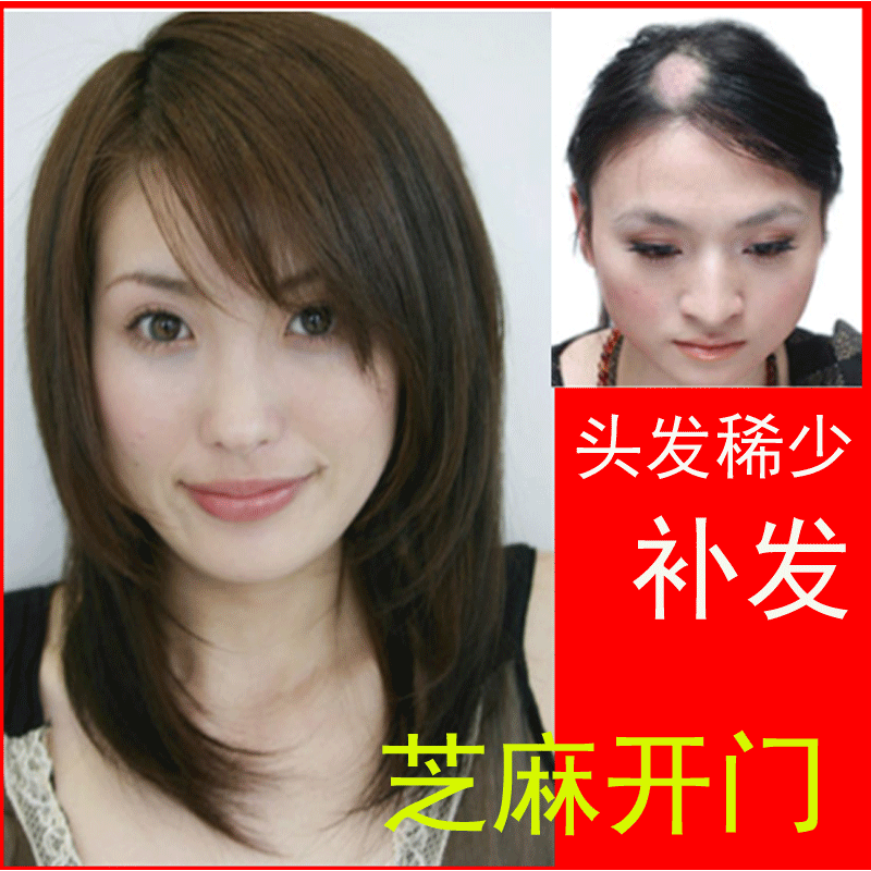 掉<em>头发</em>/<em>头发脱发</em>/女性补发/<em>头发</em>稀少<em>怎么办</em>/假发