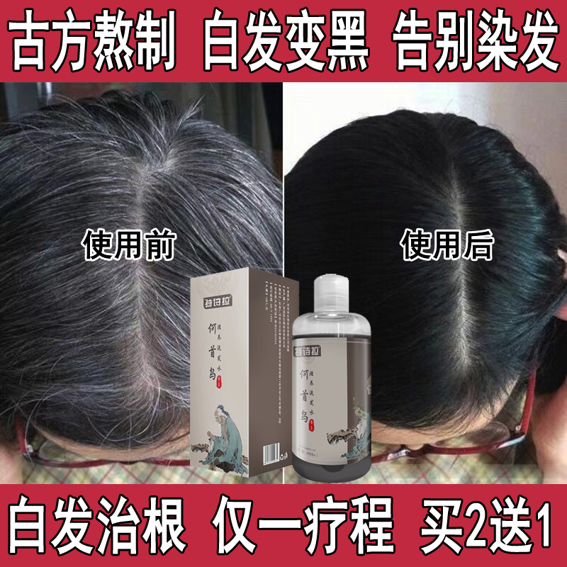 何首烏洗發水白轉黑發治根産後中老年少年白發變黑發烏發液純植物在類目 美髮護髮/假髮, 洗髮護髮(新), 洗髮水中 - 來自Buy2taobao.com提供專業的淘寶代購服務