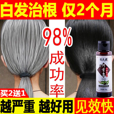 德生源何首乌黑发液治白发变黑发少白头中老年产后白发转黑乌发液