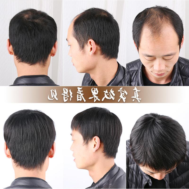 手织假发男补发块 真发补发 无痕盖白发 寸头短发地中海秃顶发片在类目 美发护发/假发, 假发, 其它假发中 - 来自Buy2taobao.com提供专业的淘宝代购服务