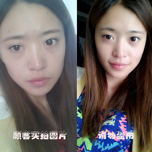 正品伊始美容金水去痣点痣药水无痕祛痣平瘊点