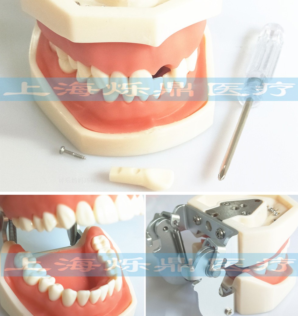 operation Practice Model Stomatology Department study Model Can extract teeth Removing teeth Shoulderin the Toy/Childs/Puzzle/Building block/Model , Static model , Other model toys category - from Buy2taobao.com to provide professional Taobao agent buy service