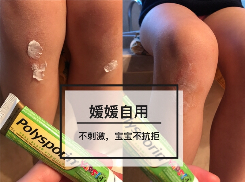 加拿大代购Polysporin儿童创伤愈合膏抗 菌消 炎镇痛30g在类目 尿片/洗护/喂哺/推车床, 其它婴童用品中 - 来自Buy2taobao.com提供专业的淘宝代购服务