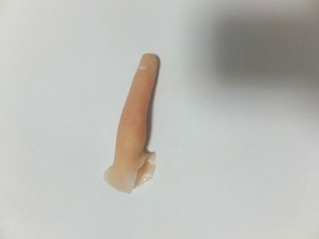 假手指断指定做硅胶手指头医用假指假肢定做