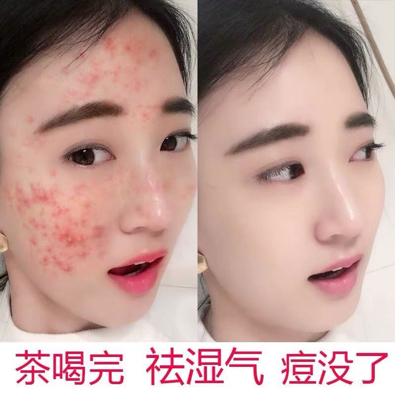 调湿去胖 赶走痘痘 喝出好身材 拥有自信美 红豆薏米茶在类目 传统滋补营养品, 养生茶中 - 来自Buy2taobao.com提供专业的淘宝代购服务