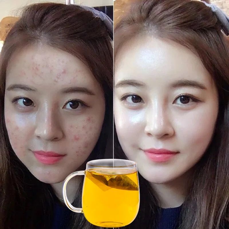 Dehumidifying and removing fat Get rid of acne Drink a good figure Have confidence and beauty Red beans and barley teain the Traditional nourishing food , Health tea category - from Buy2taobao.com to provide professional Taobao agent buy service