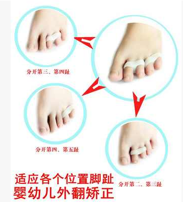 婴幼儿童拇外翻矫正器宝宝小孩超软硅胶脚趾重叠纠正器分趾分离器在类目 个人护理/保健/按摩器材, 家用保健器材, 保健护具(护腰/膝/腿)中 - 来自Buy2taobao.com提供专业的淘宝代购服务