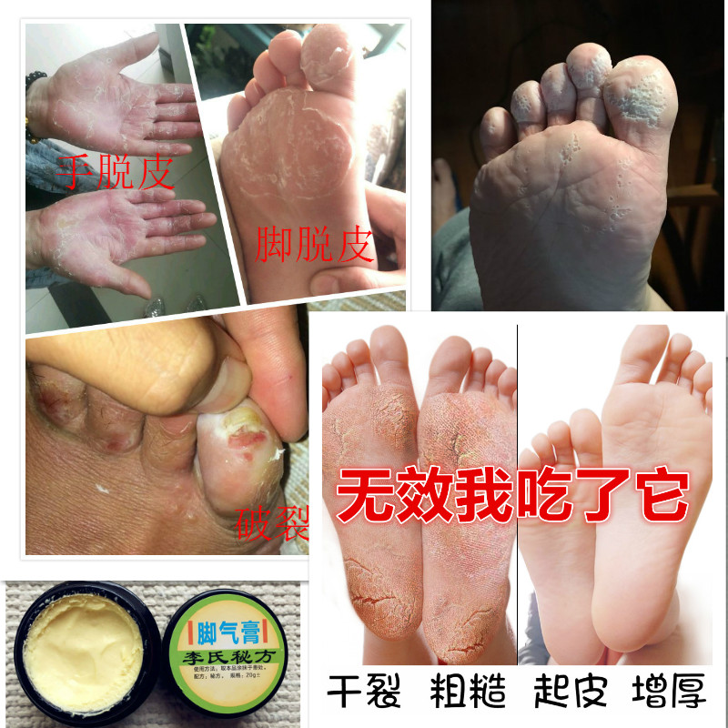 Lee Herbs Heel Chapped Chap cream Crack Chapped Cracking Brothers Healing cream moist Athlete's foot creamin the Localization of life services , Health Services , Foot/Bath/Massage category - from Buy2taobao.com to provide professional Taobao agent buy service