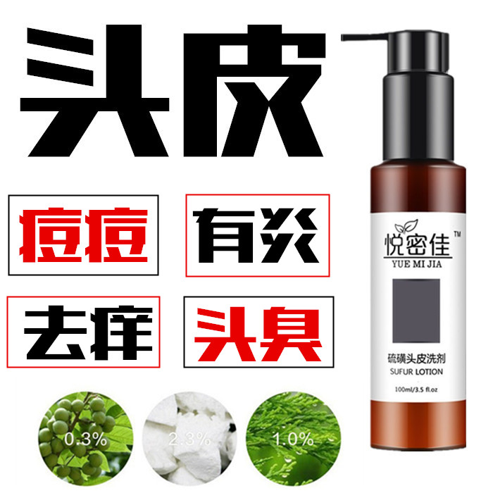 头皮毛囊洗炎去疙瘩红肿痘痘头皮洗发水露皮肤痤疮去屑止痒去螨虫|msdalam kategori Penjagaan rambut/rambut palsu, Syampu Rambut (baru), syampu - dari Buy2taobao.com untuk memberikan perkhidmatan ejen Taobao profesional membeli