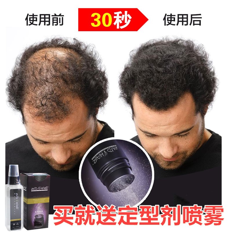 盖脱林密发纤维 美发粉头发浓发生发神器补发假发喷雾剂增发纤维|msdalam kategori Penjagaan rambut/rambut palsu, rambut palsu, wigs lain - dari Buy2taobao.com untuk memberikan perkhidmatan ejen Taobao profesional membeli