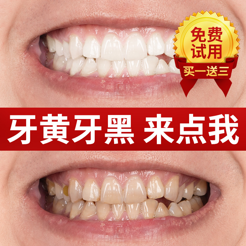 【买1送3】牙齿变白洗白去黄非美白刷去牙烟渍小苏打洁牙神器|ruв категории туалетные чище/санитарно - гигиенических салфеток/бумага/Ароматерапия, шампунь/человек чистой, полости рта, зубной порошок - от Buy2taobao.com для оказания профессиональной услуги покупки агента Taobao