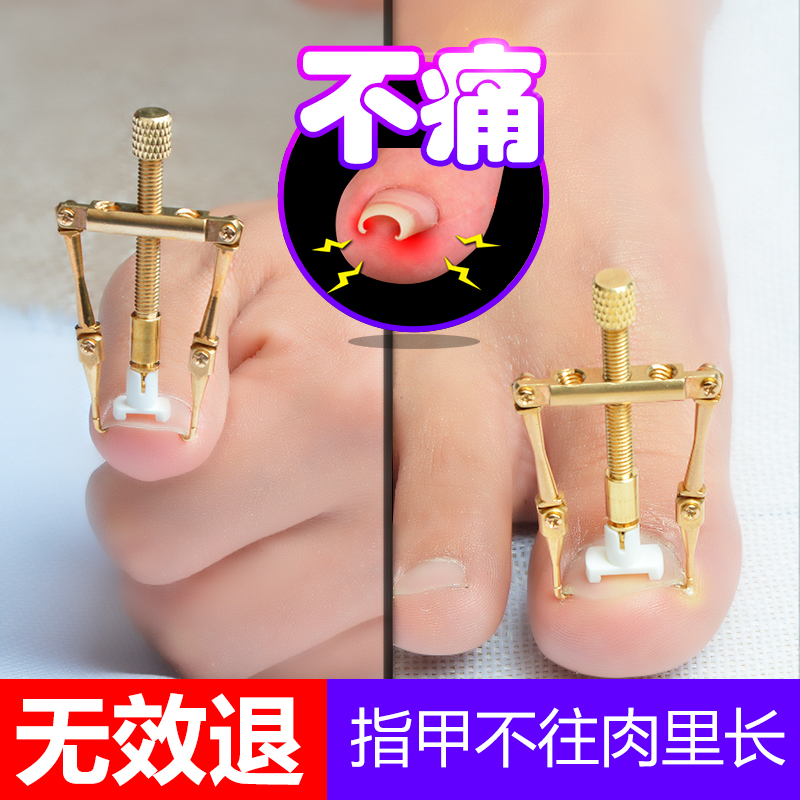 Life Li Ingrown Toenails Orthotic device Toenail correct Patch Paronychia Fingernails Correct Artifactin the Personal Care/Health/Massage equipment , Slimming , Nail Care category - from Buy2taobao.com to provide professional Taobao agent buy service