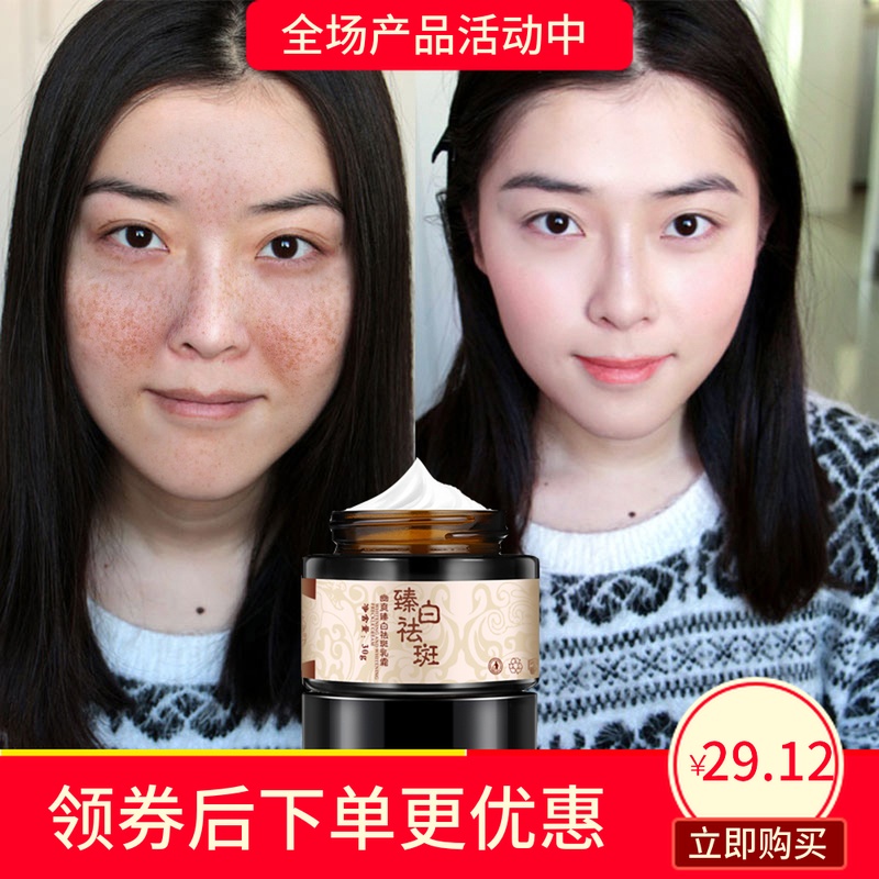 Arbutin skin whitening Freckle cream Pale spot Moisture Replenish water Remove freckles Chloasma Stain Freckle product face without makeupin the Care cleaners/Sanitary napkins/Paper/Aromatherapy , Shampoo bath/Personal cleanliness , Facial Cleansing/Nurse , Emulsion/Cream category - from Buy2taobao.com to provide professional Taobao agent buy service