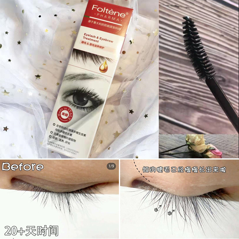 ponytimes Long eyelashes artifact|Feng Tim Foltene eyelash increase Essence liquid 8ml Thick Lengthening Toughin the Makeup/Perfume/Beauty tools , Mascara/Eyelash growth medium category - from Buy2taobao.com to provide professional Taobao agent buy service