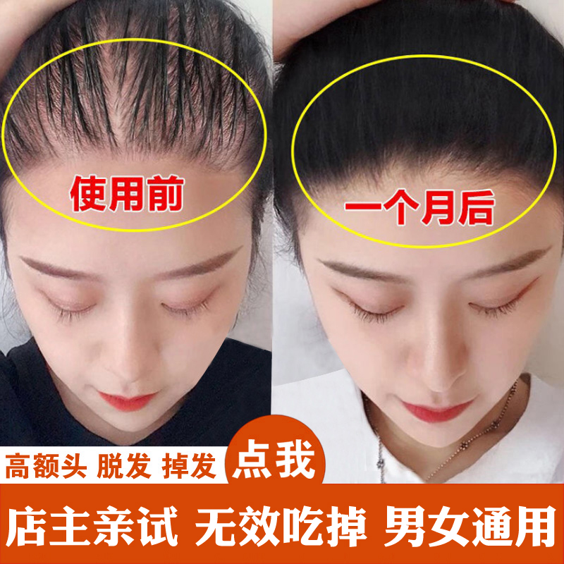 楚颜乐洗喜力丝密生发洗发水防脱发育发液宜黑发莱雅官网正品|msdalam kategori Penjagaan rambut/rambut palsu, Syampu Rambut (baru), syampu - dari Buy2taobao.com untuk memberikan perkhidmatan ejen Taobao profesional membeli