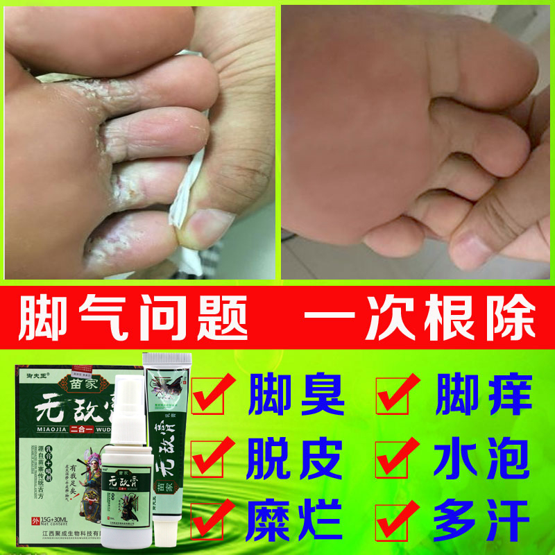 脚气喷剂治療脚痒去根神器止癢真菌脱皮除脚臭脚汗泡脚粉药膏克星在类目 本地化生活服务, 健康服务, 足浴/洗浴/按摩中 - 来自Buy2taobao.com提供专业的淘宝代购服务