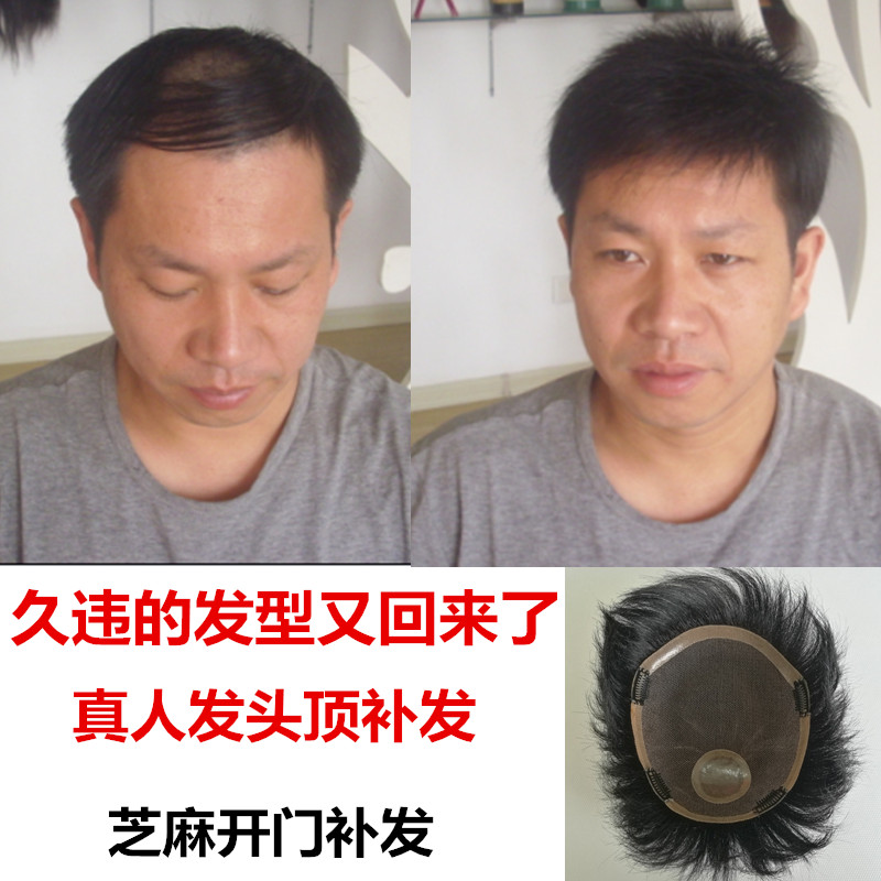 递针工艺男发片 胶粘假发片 男士补发发片 头顶稀少织发补发|msdalam kategori Penjagaan rambut/rambut palsu, rambut palsu, lembaran lurus - dari Buy2taobao.com untuk memberikan perkhidmatan ejen Taobao profesional membeli