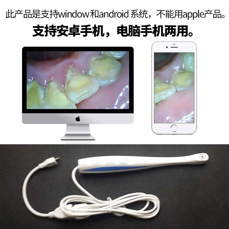 household Stomatology Department Intraoral Camera Oral camera USB Interface Even software Stomatology Department Dental photographin the Personal Care/Health/Massage equipment , Oral Care , Other oral therapy equipment category - from Buy2taobao.com to provide professional Taobao agent buy service