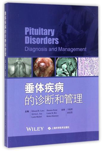 垂体疾病的诊断和管理 书 编者:(美)爱德华·劳斯|译者:卞留贯//孙青芳 上海科技在类目 书籍/杂志/报纸, 医学卫生, 医学其它中 - 来自Buy2taobao.com提供专业的淘宝代购服务