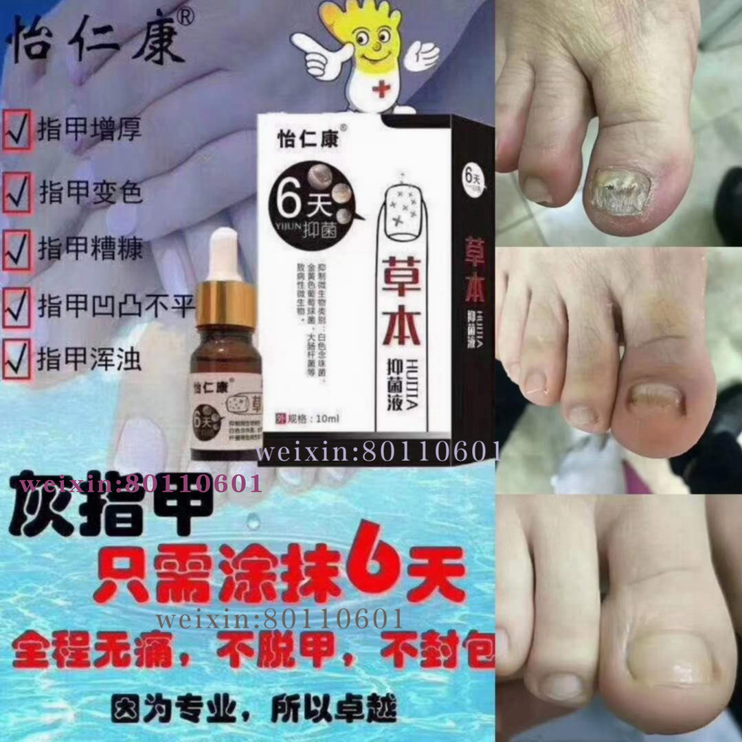 Excelcare Herbal Bacteriostasis Pure natural Herb Do not remove armor No manicure No armor No recurrencein the Home Daily , Protective Equipment , Hand Protection Supplies category - from Buy2taobao.com to provide professional Taobao agent buy service