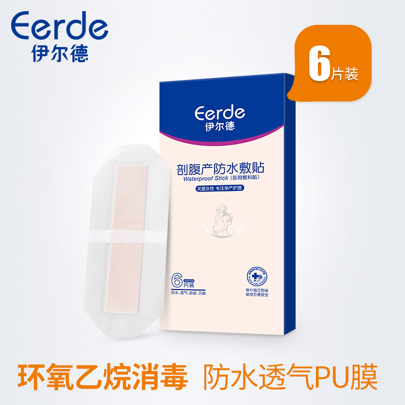 Yi Erde Caesarean Waterproof sticker Caesarean Section Maternal operation take a shower Edge Wound paste Cesarean section sterile Applicatorin the Maternity/Maternal supplies/Nutrition , Prenatal and postnatal mother supplies , Other category - from Buy2taobao.com to provide professional Taobao agent buy service