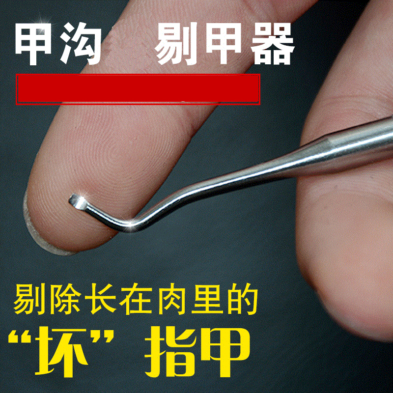 七叶足甲沟勺剔甲器甲沟矫正器甲沟异物指甲刀嵌甲专用锉炎剔翘器|ruв категории семья/личные чистящие средства, потребительских уборка посуды, маникюрные ножницы/маникюрные ножницы, гвоздь/маникюр костюм - от Buy2taobao.com для оказания профессиональной услуги покупки агента Taobao