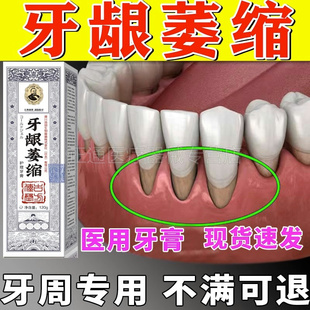 牙龈萎缩牙周炎专用牙膏牙齿松动再牙龈出血生肿痛非修护