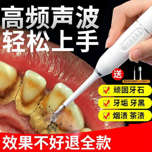 冲洗牙齿神器洗牙器冲牙器牙齿清洗 冲牙器电动去黄牙垢口臭牙渍