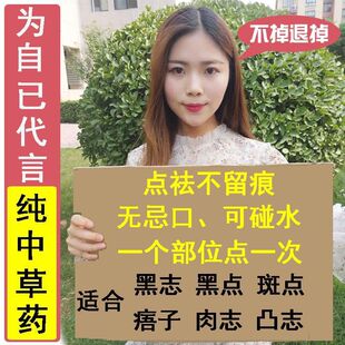 点痣去痣药水无痕祛痣膏脸部去斑祛斑痦子取痣除痣黑点雀斑水