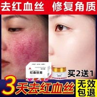 红血丝修复去除脸部角质层薄修复敏感肌，肤泛红淡化大红脸专用面霜