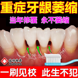 牙龈萎缩修复再生特效药牙齿外露牙周炎治疗药专用护龈修护牙膏