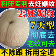 妊娠纹产后消除修复霜油预防孕妇专用生长纹，肥胖纹淡化紧致祛除去