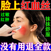 过敏皮肤修复脸部医用去红血丝药膏敏感肌泛红痒肿男女士干燥起皮