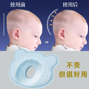 婴儿定型枕矫正扁头防偏头神器0-1岁宝宝枕头，新生儿纠正头型透气