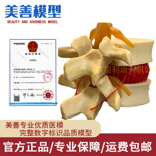 脊柱模型 脊椎骨头腰椎间盘模具 椎体模型 突出受压病理骨质教具