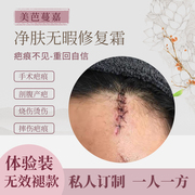 草本疤痕疙瘩修复膏剖腹产，手术专用去除脸部，增生凹凸起软化霜