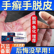 手癣膏脱皮干裂真菌感染湿疹去止痒根烂手鹅掌风手藓手足癣药膏JW