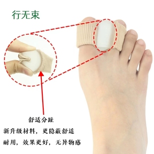拇指外翻矫正器大脚骨，姆趾分离器大脚趾外翻，纠正脚趾矫正器可穿鞋