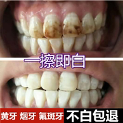 牙齿美白速效去除黄牙烟渍氟斑牙清洁去黄洗牙液洁白牙贴变白神器