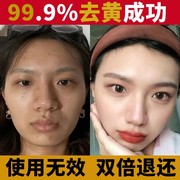 小分子美白淡斑精华安瓶祛黄补水保湿紧致抗皱提亮肤色淡化黑色素