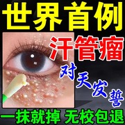 汗管留眼部去除神器，专用药膏祛油脂粒眼周颗粒，眼脸黄瘤消除眼霜