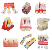 牙科材料牙齿教学模型透明病理，牙模白钢玉牙头骨，蛀牙模型种植玩具