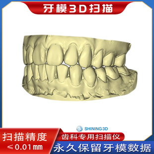 3D扫描牙模 获取石膏牙齿 三维数据保存 定制牙齿保持器 夜磨牙套