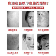 红血丝修复去除脸部角质层薄修复敏感肌，肤泛红淡化大红脸专用面霜