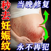 妊辰纹消除去妊娠纹紧致肚皮产后肥胖纹修复霜淡化疤痕修复除疤膏