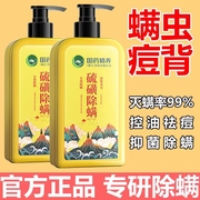 上海硫磺皂除螨沐浴露，除螨虫皮肤瘙痒祛痘止痒硫黄香皂