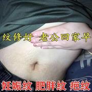 去妊娠纹肚子妊辰纹产后消除大腿肥胖纹生长纹预防紧致产后修复霜