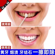 小苏打牙齿美白牙膏速效，去除黄牙烟渍牙结石去黄去口臭去牙渍洗白